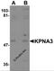 Karyopherin Subunit Alpha 3 antibody, 5985, ProSci Inc, Western Blot image 