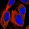 TNFAIP3 Interacting Protein 1 antibody, NBP1-89306, Novus Biologicals, Immunocytochemistry image 