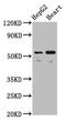 Lectin, Mannose Binding 1 antibody, LS-C674974, Lifespan Biosciences, Western Blot image 