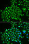 Recoverin antibody, STJ28487, St John
