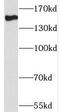 THO Complex 2 antibody, FNab08667, FineTest, Western Blot image 