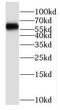 Prolyl 4-Hydroxylase Subunit Alpha 2 antibody, FNab06080, FineTest, Western Blot image 