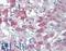 THEM6 antibody, LS-A8243, Lifespan Biosciences, Immunohistochemistry paraffin image 