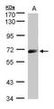 Interleukin 12 Receptor Subunit Beta 1 antibody, GTX103917, GeneTex, Western Blot image 