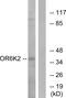 Olfactory Receptor Family 6 Subfamily K Member 2 antibody, GTX87756, GeneTex, Western Blot image 