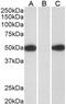 Actin Alpha 2, Smooth Muscle antibody, ab21027, Abcam, Western Blot image 