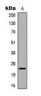 Crystallin Alpha B antibody, orb393254, Biorbyt, Western Blot image 
