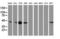 Vasodilator Stimulated Phosphoprotein antibody, LS-C172706, Lifespan Biosciences, Western Blot image 