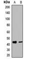 Ubiquitin-conjugating enzyme E2 Q2 antibody, LS-C668930, Lifespan Biosciences, Western Blot image 