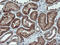 Monoamine Oxidase A antibody, M03326, Boster Biological Technology, Immunohistochemistry paraffin image 