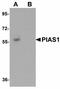 Protein Inhibitor Of Activated STAT 1 antibody, orb89876, Biorbyt, Western Blot image 