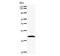 Aryl Hydrocarbon Receptor Nuclear Translocator Like 2 antibody, LS-C342828, Lifespan Biosciences, Western Blot image 