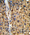 Glutathione S-Transferase Alpha 2 antibody, LS-C166704, Lifespan Biosciences, Immunohistochemistry paraffin image 