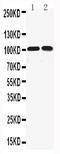 Potassium Voltage-Gated Channel Subfamily Q Member 5 antibody, PA2300, Boster Biological Technology, Western Blot image 