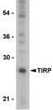 Toll Like Receptor Adaptor Molecule 2 antibody, MBS395875, MyBioSource, Western Blot image 