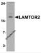 Late Endosomal/Lysosomal Adaptor, MAPK And MTOR Activator 2 antibody, 7711, ProSci, Western Blot image 