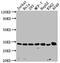 Cyclin Dependent Kinase 4 antibody, CSB-RA697694A0HU, Cusabio, Western Blot image 