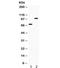 Zona Pellucida Glycoprotein 1 antibody, R32398, NSJ Bioreagents, Western Blot image 