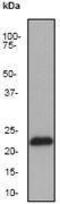 CASP2 And RIPK1 Domain Containing Adaptor With Death Domain antibody, GTX61554, GeneTex, Western Blot image 