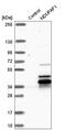 NADH:Ubiquinone Oxidoreductase Complex Assembly Factor 1 antibody, HPA040064, Atlas Antibodies, Western Blot image 
