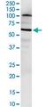 Nudix Hydrolase 12 antibody, MA5-22698, Invitrogen Antibodies, Western Blot image 