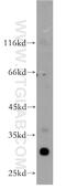 N(Alpha)-Acetyltransferase 15, NatA Auxiliary Subunit antibody, 14394-1-AP, Proteintech Group, Western Blot image 