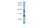 Dolichyldiphosphatase 1 antibody, A15409, Boster Biological Technology, Western Blot image 