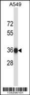 NSF Attachment Protein Beta antibody, 57-589, ProSci, Western Blot image 