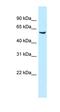 Meis Homeobox 1 antibody, orb329965, Biorbyt, Western Blot image 