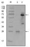 Solute Carrier Family 22 Member 1 antibody, AM06232SU-N, Origene, Western Blot image 