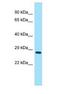 Protein 4930567H17Rik antibody, NBP1-98255, Novus Biologicals, Western Blot image 