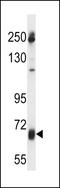 Gamma-Glutamyltransferase 7 antibody, LS-C166461, Lifespan Biosciences, Western Blot image 