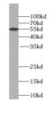 Spectrin Repeat Containing Nuclear Envelope Protein 2 antibody, FNab08436, FineTest, Western Blot image 