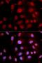 DNA Polymerase Beta antibody, LS-C331633, Lifespan Biosciences, Immunofluorescence image 