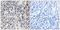 Estrogen Receptor 2 antibody, PA5-39774, Invitrogen Antibodies, Immunohistochemistry frozen image 