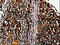 Matrix Metallopeptidase 13 antibody, CSB-PA797584, Cusabio, Immunohistochemistry paraffin image 