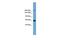 Terminal Uridylyl Transferase 4 antibody, PA5-44931, Invitrogen Antibodies, Western Blot image 