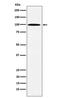 Adaptor Related Protein Complex 1 Subunit Gamma 1 antibody, M12998, Boster Biological Technology, Western Blot image 