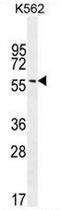 Eukaryotic Translation Initiation Factor 2B Subunit Delta antibody, AP51392PU-N, Origene, Western Blot image 