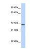 Solute Carrier Family 25 Member 42 antibody, NBP1-59605, Novus Biologicals, Western Blot image 