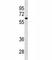 Cytochrome P450 Family 1 Subfamily A Member 2 antibody, F53655-0.1ML, NSJ Bioreagents, Western Blot image 