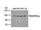 Protein Kinase D1 antibody, orb14532, Biorbyt, Western Blot image 