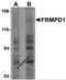 FERM And PDZ Domain Containing 1 antibody, 5453, ProSci, Western Blot image 