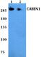 Calcineurin-binding protein cabin-1 antibody, PA5-75819, Invitrogen Antibodies, Western Blot image 