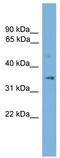Solute Carrier Family 25 Member 19 antibody, TA333721, Origene, Western Blot image 