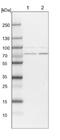Phosphatidylinositol Glycan Anchor Biosynthesis Class B antibody, NBP1-85856, Novus Biologicals, Western Blot image 