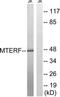 Mitochondrial transcription termination factor 1 antibody, TA314710, Origene, Western Blot image 
