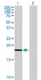 Phospholipase A And Acyltransferase 4 antibody, LS-C198063, Lifespan Biosciences, Western Blot image 