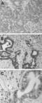 BCL2 Associated Athanogene 3 antibody, NBP2-27398, Novus Biologicals, Immunohistochemistry paraffin image 