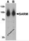 Sterile Alpha And TIR Motif Containing 1 antibody, 6917, ProSci, Western Blot image 